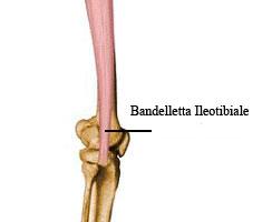 Bandelletta Ileotibiale